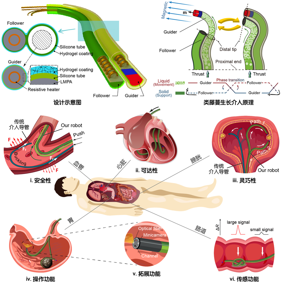 哈工大机电学院谢晖教授团队研制出仿藤蔓生长连续体机器人 助力腔内介入手术精准安全