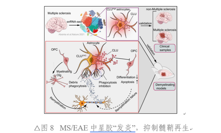 中山大学附属第三医院脑病中心联合香港中文大学揭示多发性硬化髓鞘再生障碍新机制