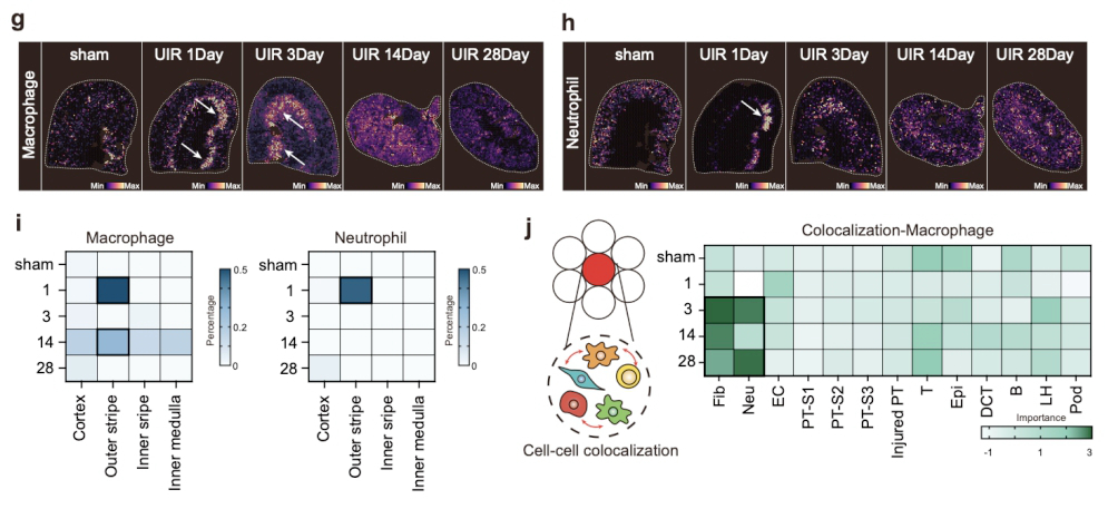 东南大学刘必成和吕林莉教授团队在揭示AKI向CKD转变上取得重要进展