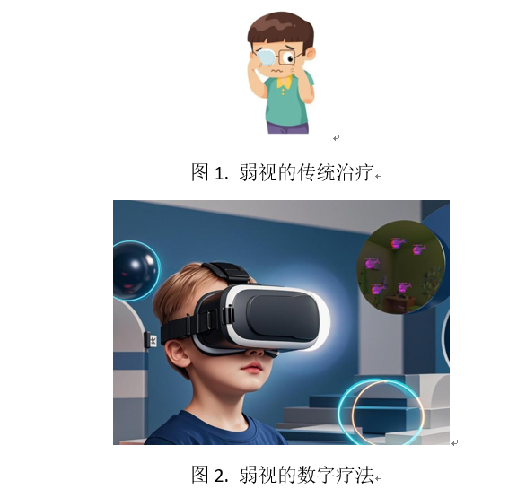 中山大学李劲嵘团队揭示弱视数字疗法过程中的眼轴变化规律
