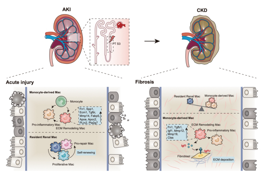 东南大学刘必成和吕林莉教授团队在揭示AKI向CKD转变上取得重要进展