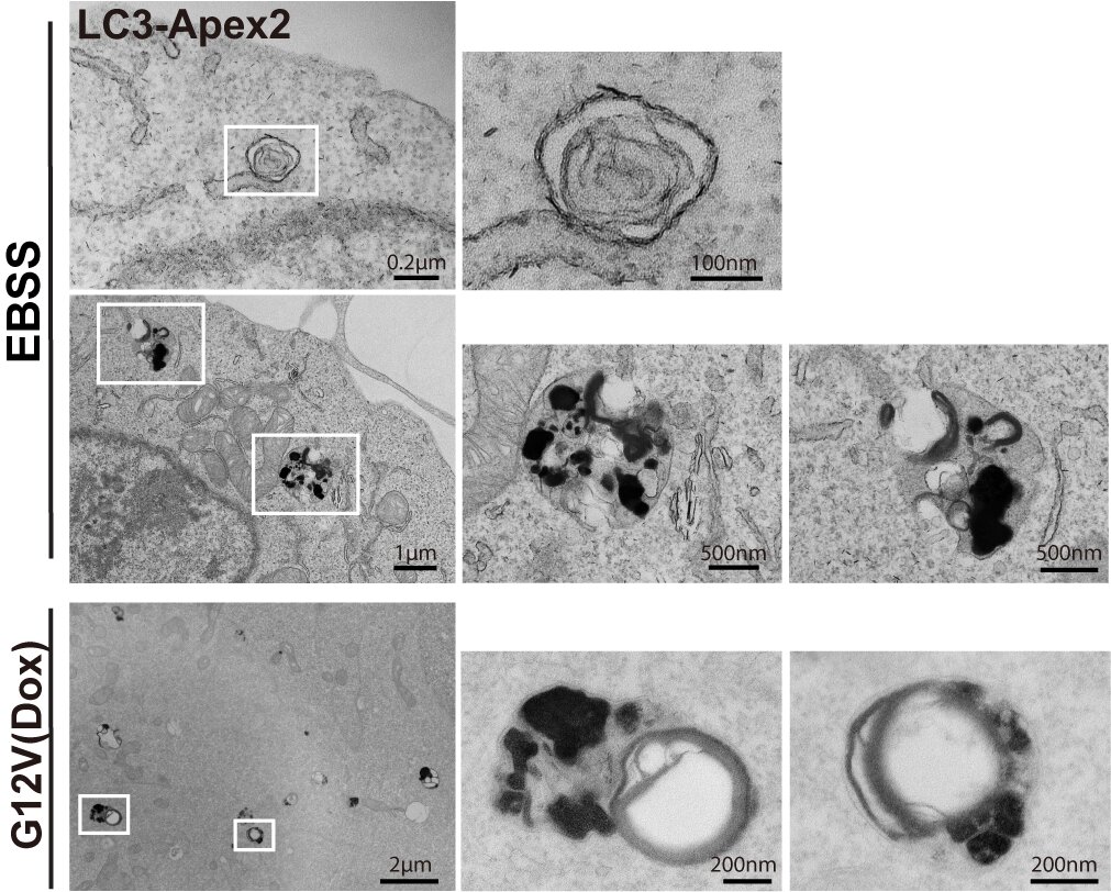 清华大学生命学院葛亮课题组合作揭示RAS突变肿瘤过程中特异性自噬的调控机制
