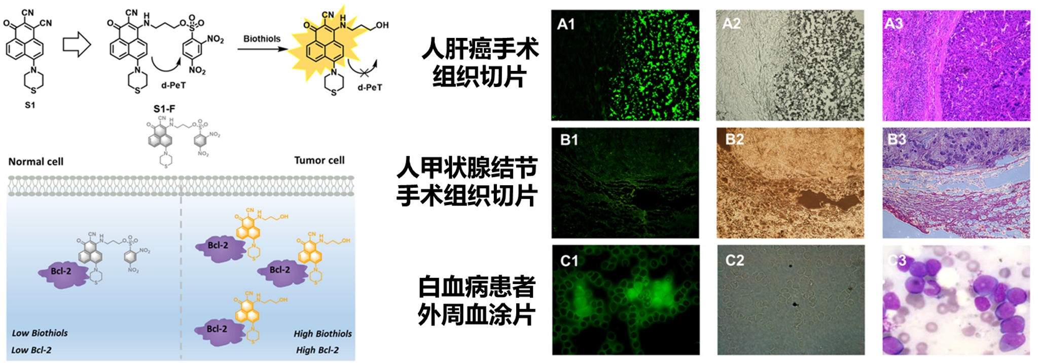 大连理工大学医学部科研团队开发一种可用于临床样本的可视化癌症诊断试剂