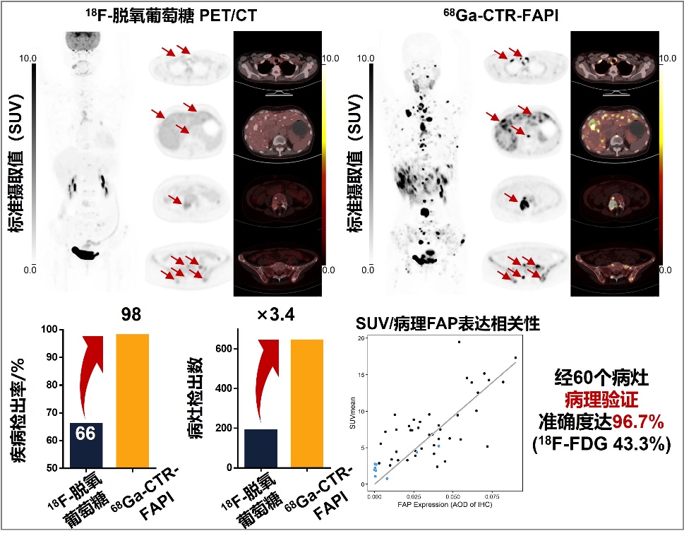 北京大学化学学院刘志博团队与合作者报道靶向共价核药物有望改变甲状腺髓样癌诊疗方案