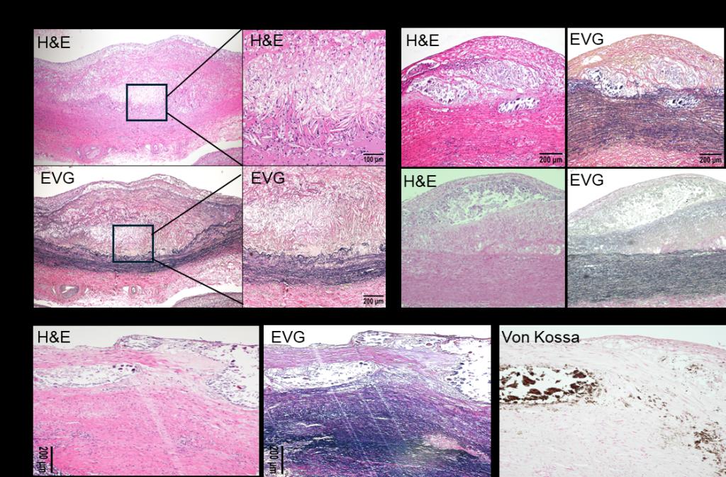 西安交大实验动物中心在动脉粥样硬化治疗研究中取得重要突破