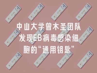 中山大学曾木圣团队发现EB病毒感染细胞的“通用钥匙”