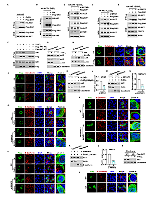 西北农林科技大学(707)动科学院蔡传江副教授在揭示Zn通过提高AKT甲基化改善仔猪肠道屏障功能障碍方面取得新进展