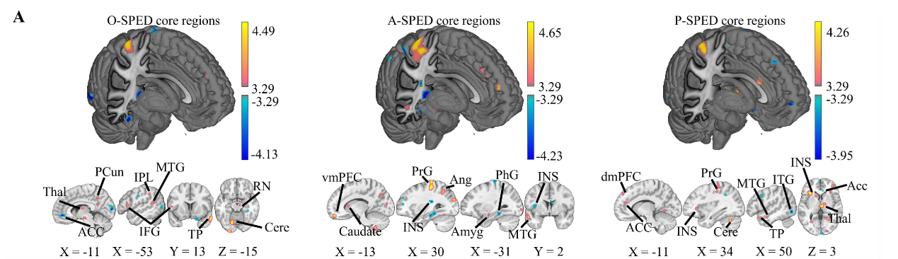 电子科技大学生命学院neuSCAN团队赵伟华副研究员在PNAS发表最新研究成果