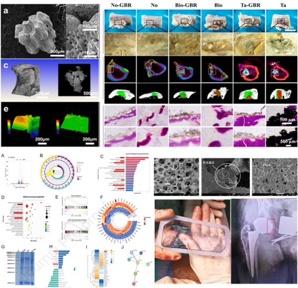 多孔钽金属植骨研究取得进展