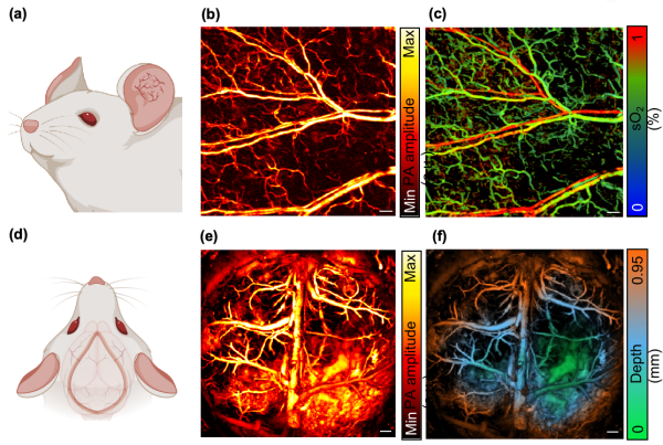 高灵敏度多光谱功能光声显微镜研制获进展