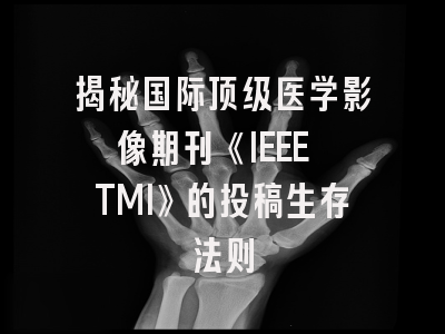揭秘国际顶级医学影像期刊《IEEE TMI》的投稿生存法则