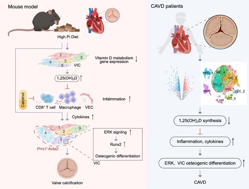 上海交大李保界课题组与合作者揭示局部维生素D代谢缺陷是瓣膜钙化的“隐形杀手”