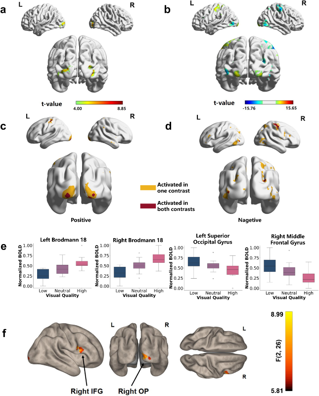 上海交大翟广涛课题组研究揭示人脑如何“脑补”模糊画面