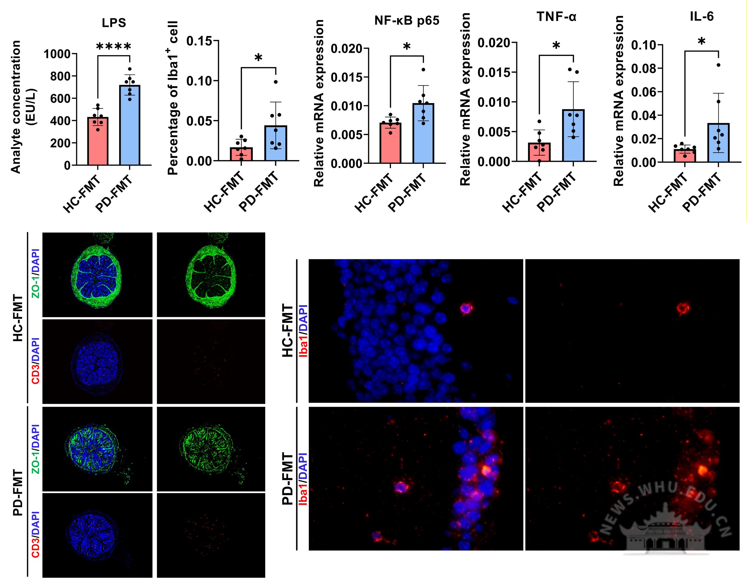 武汉大学刘燕群课题组在产前抑郁与肠道菌群研究领域取得突破