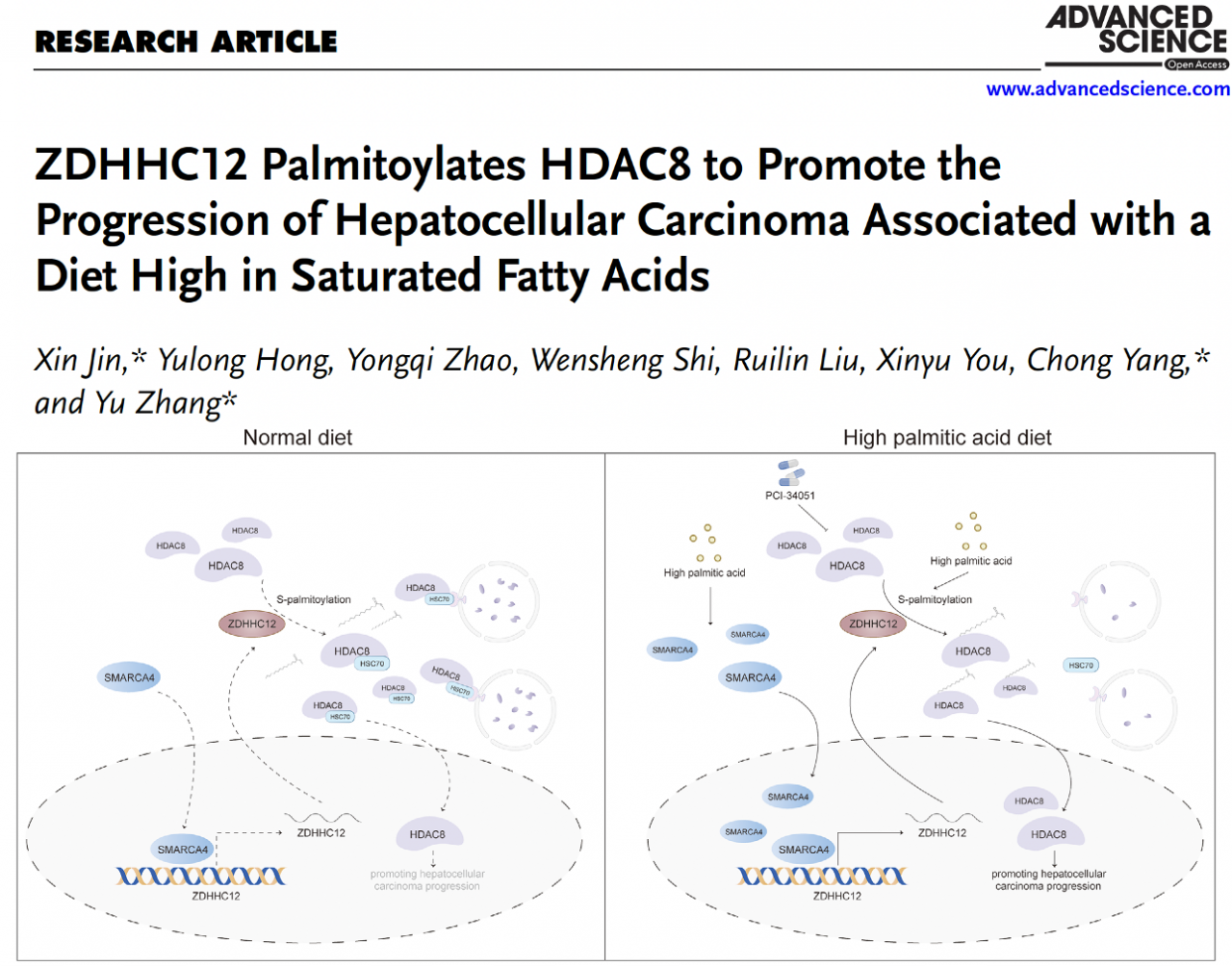 电子科技大学医学院张宇教授团队在Advanced Science发表论文