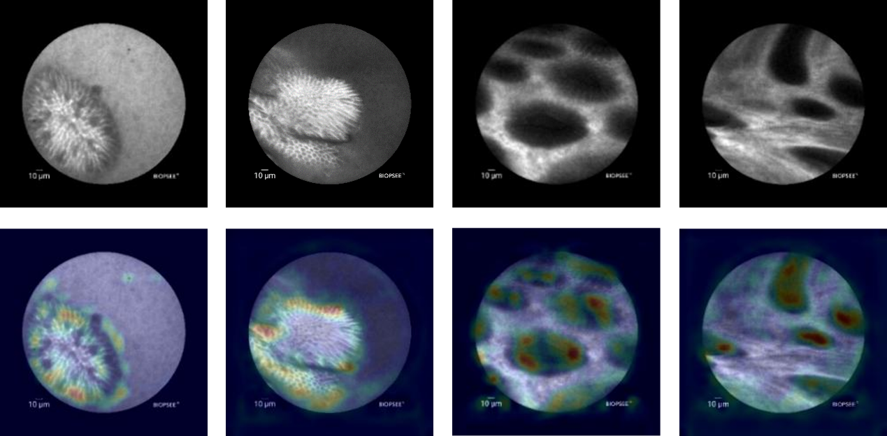 清华大学生物医学工程学院学生获第21届亚洲计算机辅助外科学术会议最佳论文奖