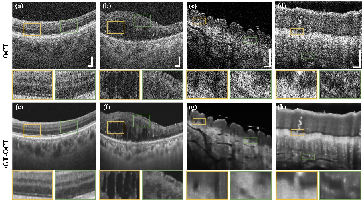 电子科技大学光电子器件与应用技术团队连续发表多项医用三维光学成像及处理研究成果