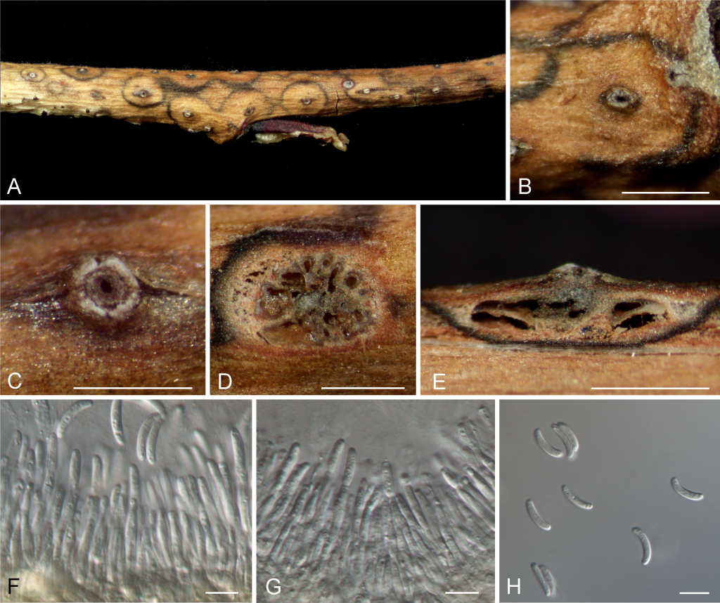 森环森保所揭示西藏林木溃疡病菌的物种多样性