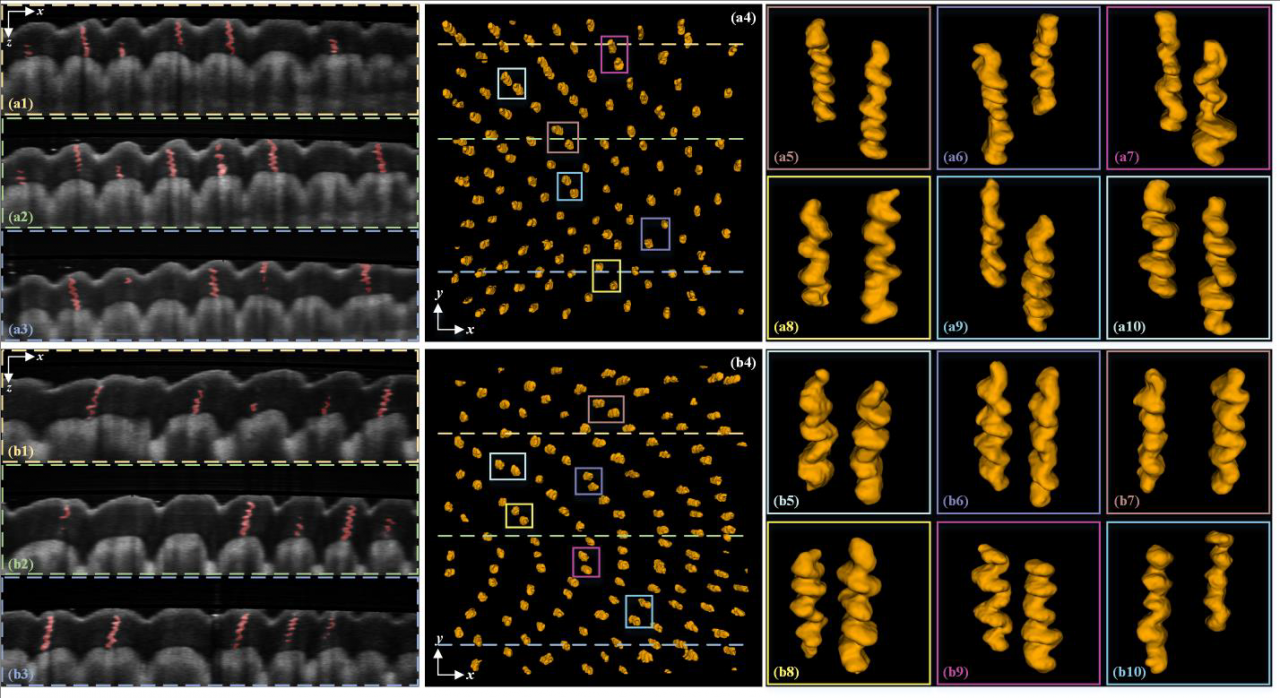 电子科技大学光电子器件与应用技术团队连续发表多项医用三维光学成像及处理研究成果