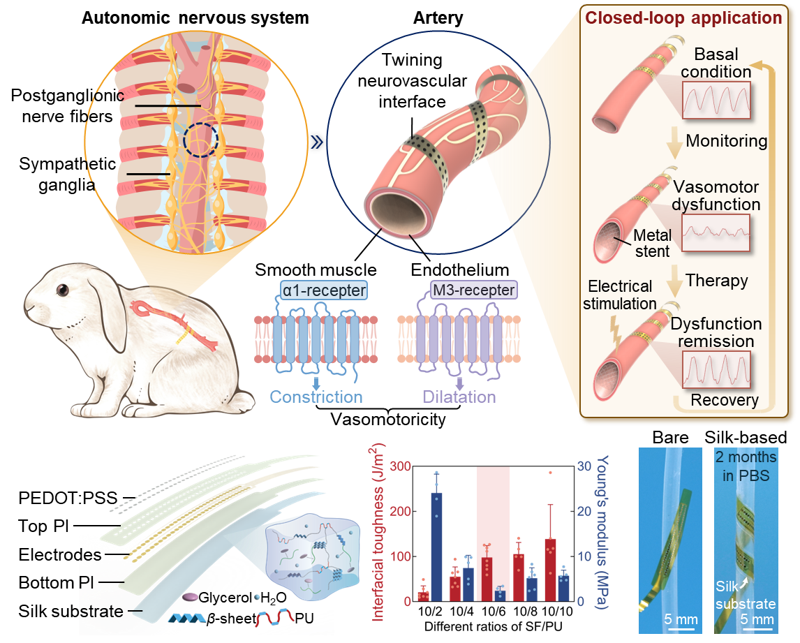 双向闭环柔性神经接口治疗血管失功研究取得进展