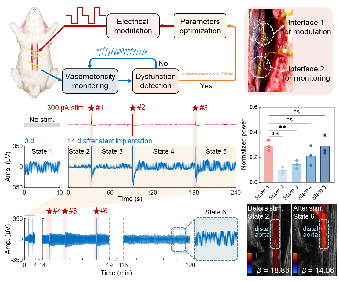 双向闭环柔性神经接口治疗血管失功研究取得进展