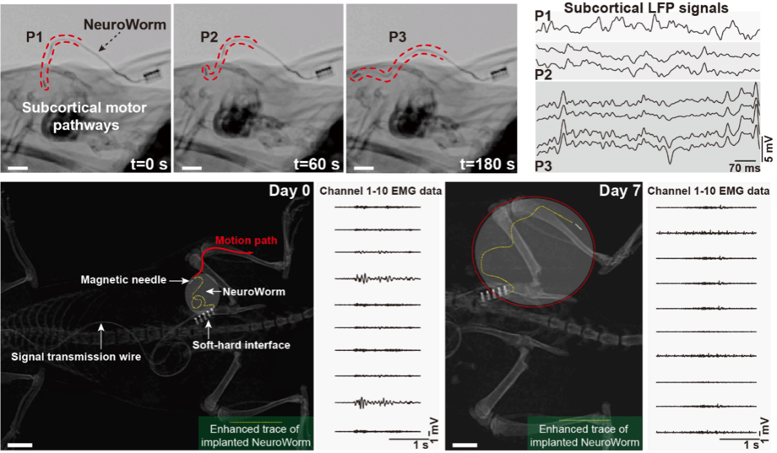 厦门大学厦大学者Nature发文 首次提出动态神经蠕虫电极概念