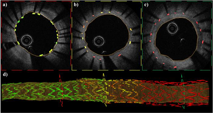 电子科技大学光电子器件与应用技术团队连续发表多项医用三维光学成像及处理研究成果