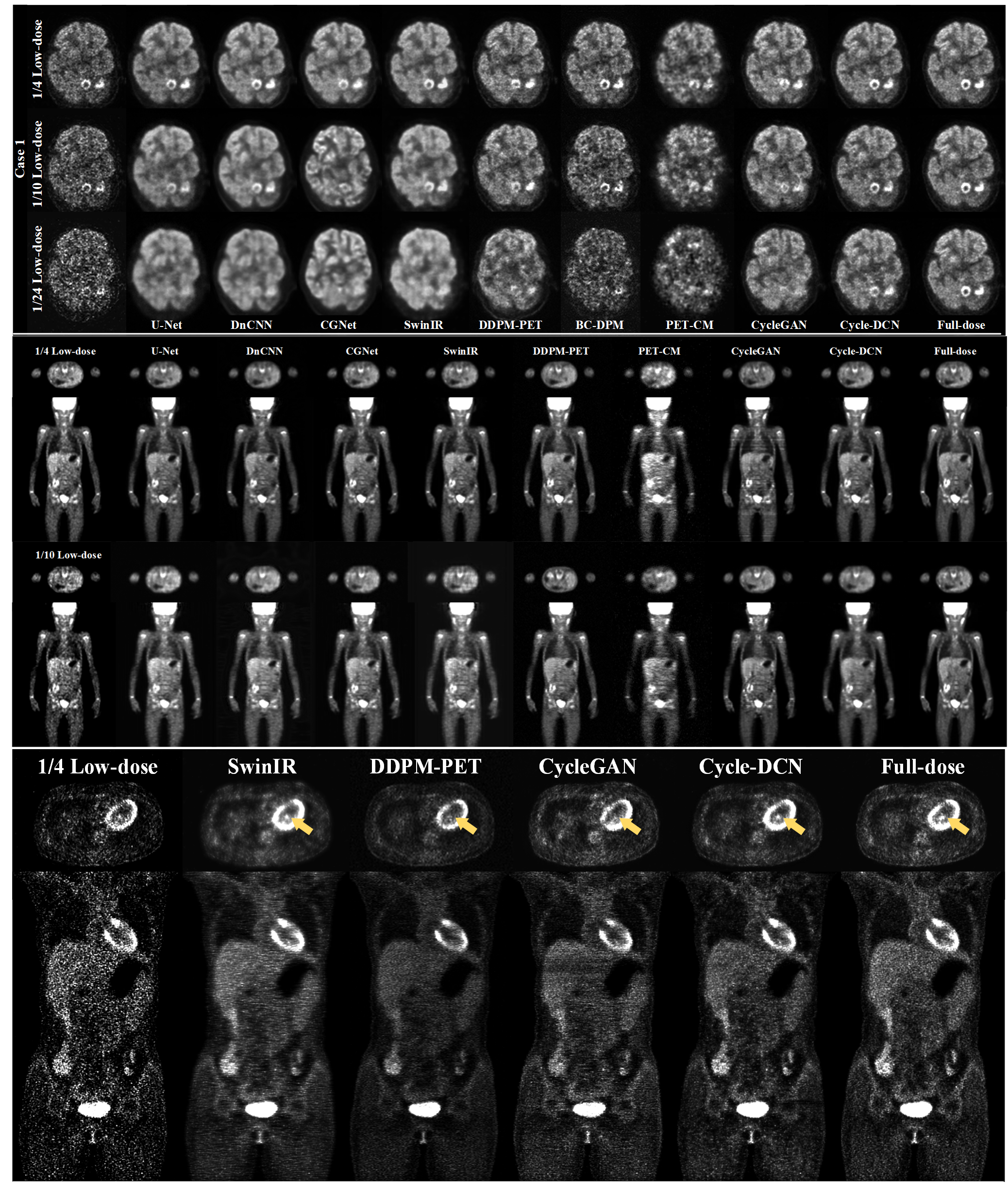 北京师范大学物理与天文学院江建勇副教授团队提出Cycle-DCN新方法实现低剂量PET图像高质量重建