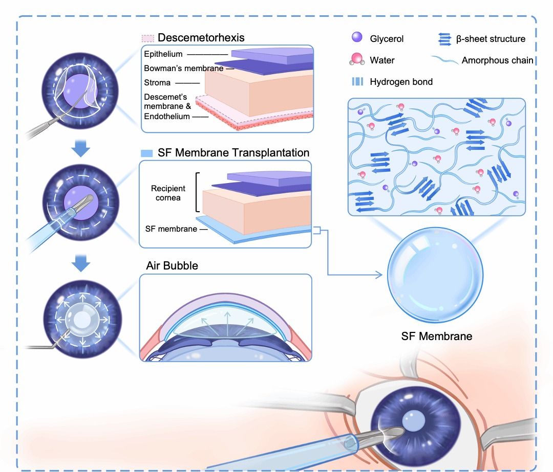 北京大学北大第三医院眼科洪晶/彭荣梅研究团队开发全球首个生物可降解角膜内皮替代物并揭示角膜内皮屏障新机制