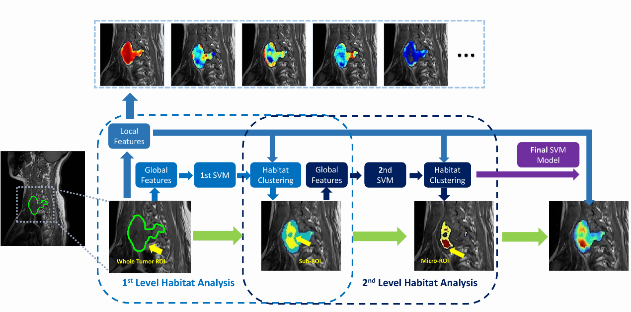北京大学北京大学第三医院放射科郎宁团队发现术前MRI影像可揭示肿瘤侵袭高危区