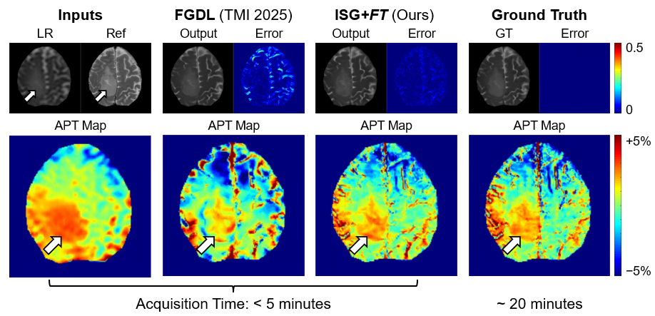 清华大学生医工程学院宋小磊课题组​实现多对比度超分辨磁共振成像增强
