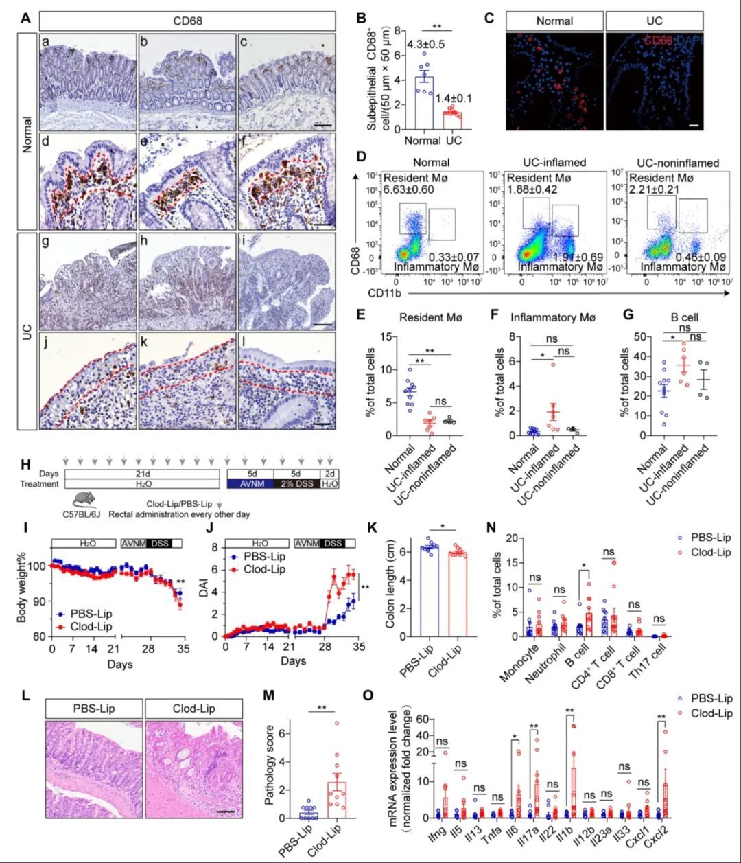 南京大学Science发文！南大团队首次发现全球公认难治性疾病的致病原因