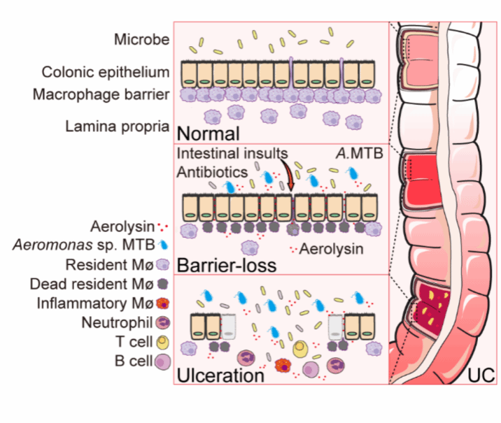 南京大学Science发文！南大团队首次发现全球公认难治性疾病的致病原因