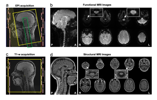 脑–脊髓同步功能磁共振开放数据库发布