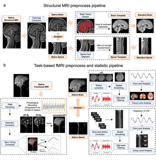 脑–脊髓同步功能磁共振开放数据库发布