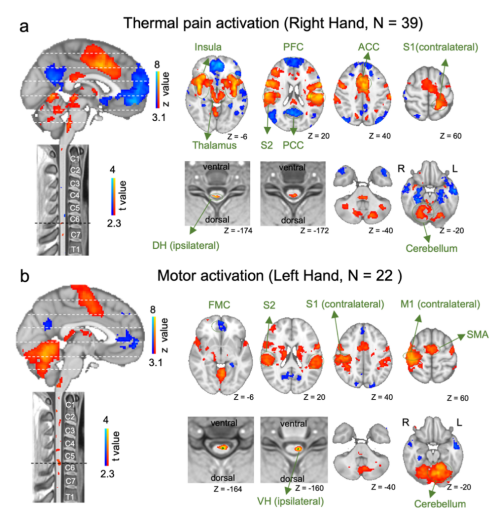 脑–脊髓同步功能磁共振开放数据库发布