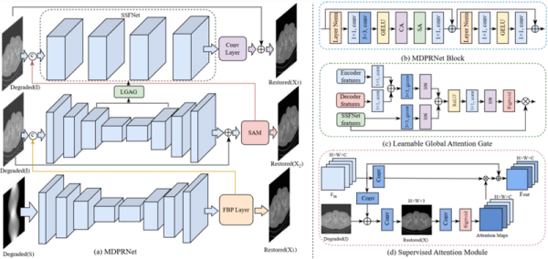 科研人员开发出稀疏视角CT重建新方法