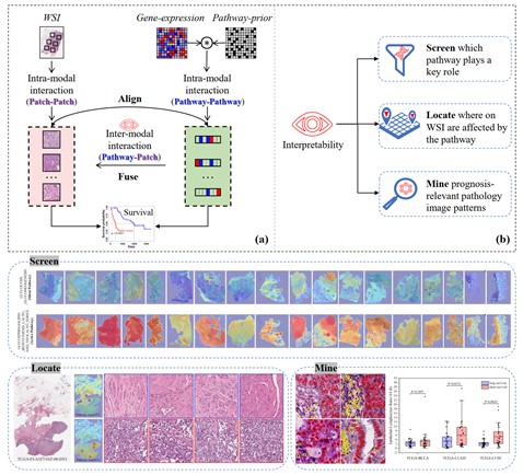 中国科大提出更精准且可解释的多模态癌症生存分析新方法
