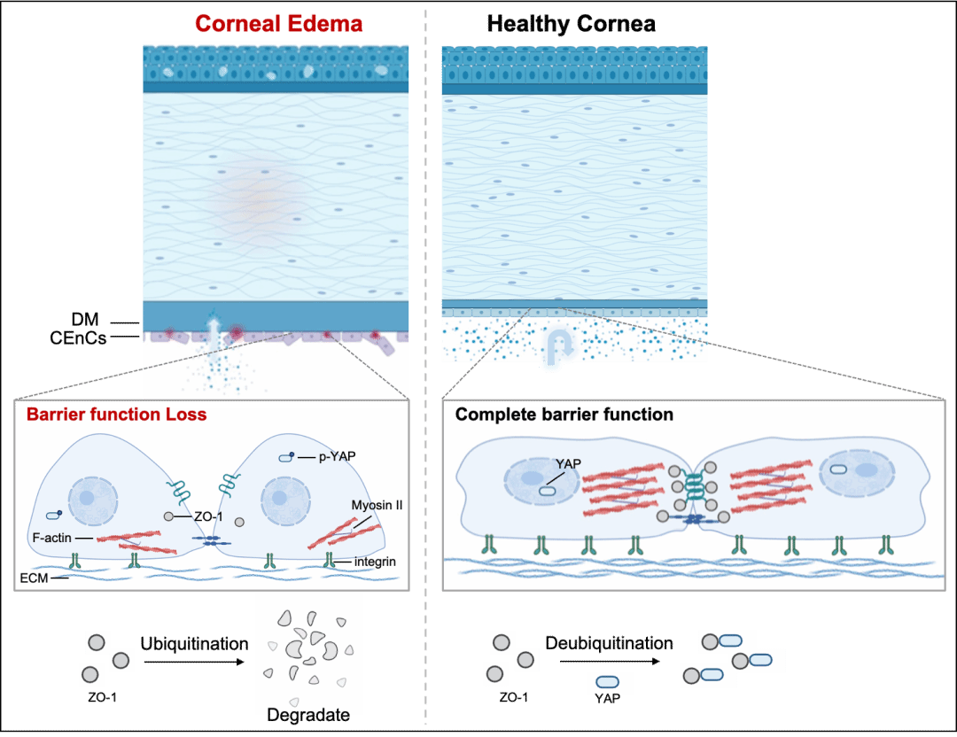 北京大学北大第三医院眼科洪晶/彭荣梅研究团队开发全球首个生物可降解角膜内皮替代物并揭示角膜内皮屏障新机制