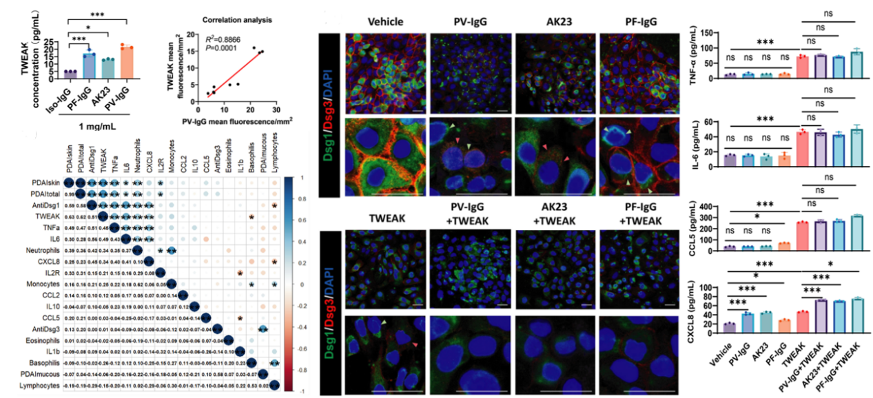 西安交大二附院皮肤病院刘亚乐/夏育民教授团队 揭示TWEAK调控寻常型天疱疮炎症反应关键机制