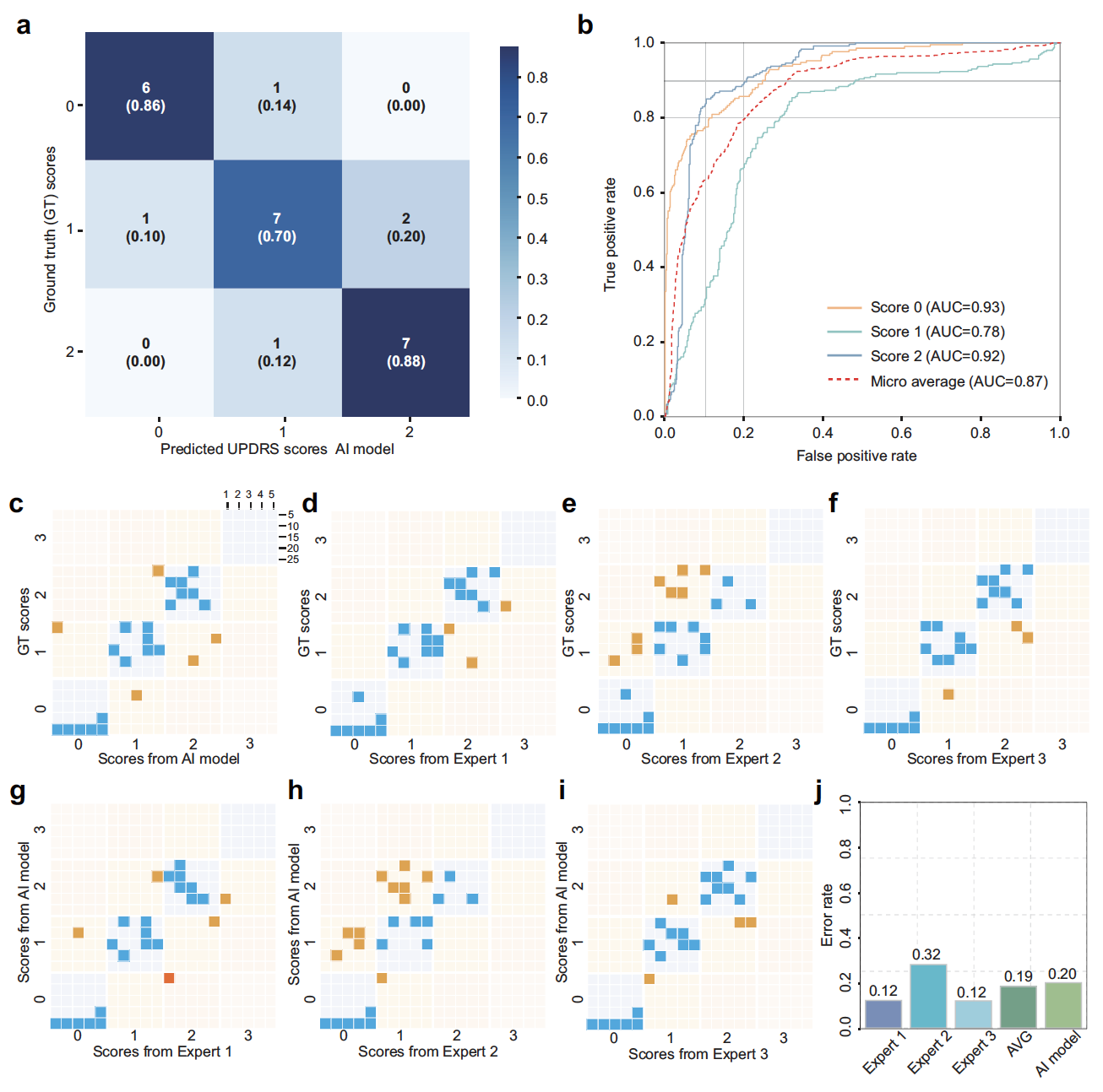 南开研究团队开发帕金森智能评估系统获新进展