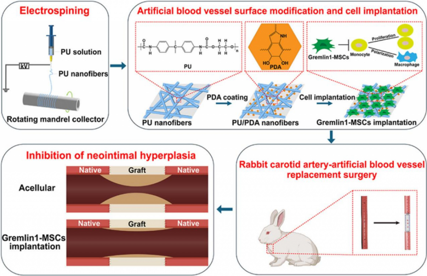 中山大学中山大学向秋玲刘瑞明项鹏合作揭示Gremlin1修饰间充质干细胞提高小口径静电纺丝聚氨酯人工血管移植通畅率