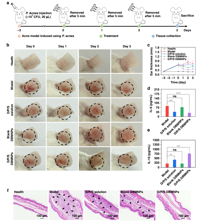 清华大学深圳国际研究生院张灿阳团队在微针透皮给药领域取得新进展