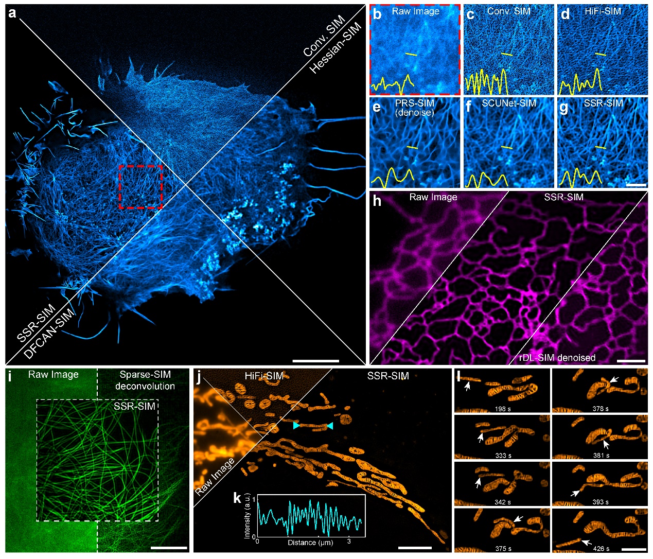 清华大学生命学院李栋课题组合作开发基于自监督重建的生物友好型高精度结构光超分辨显微成像技术