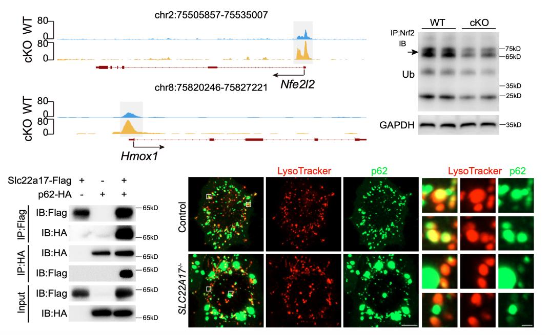清华大学药学院陈立功团队揭示SLC22A17作为大脑海马体铁代谢和感应的关键转运蛋白维持神经发生
