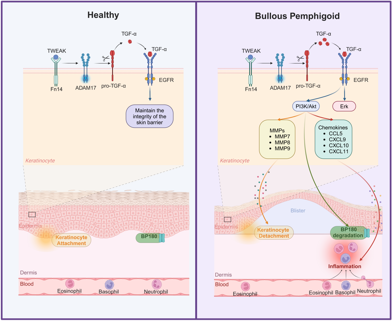 西安交大二附院皮肤病院刘亚乐/夏育民团队最新研究发现 TGF-α促使大疱性类天疱疮发病的关键机制
