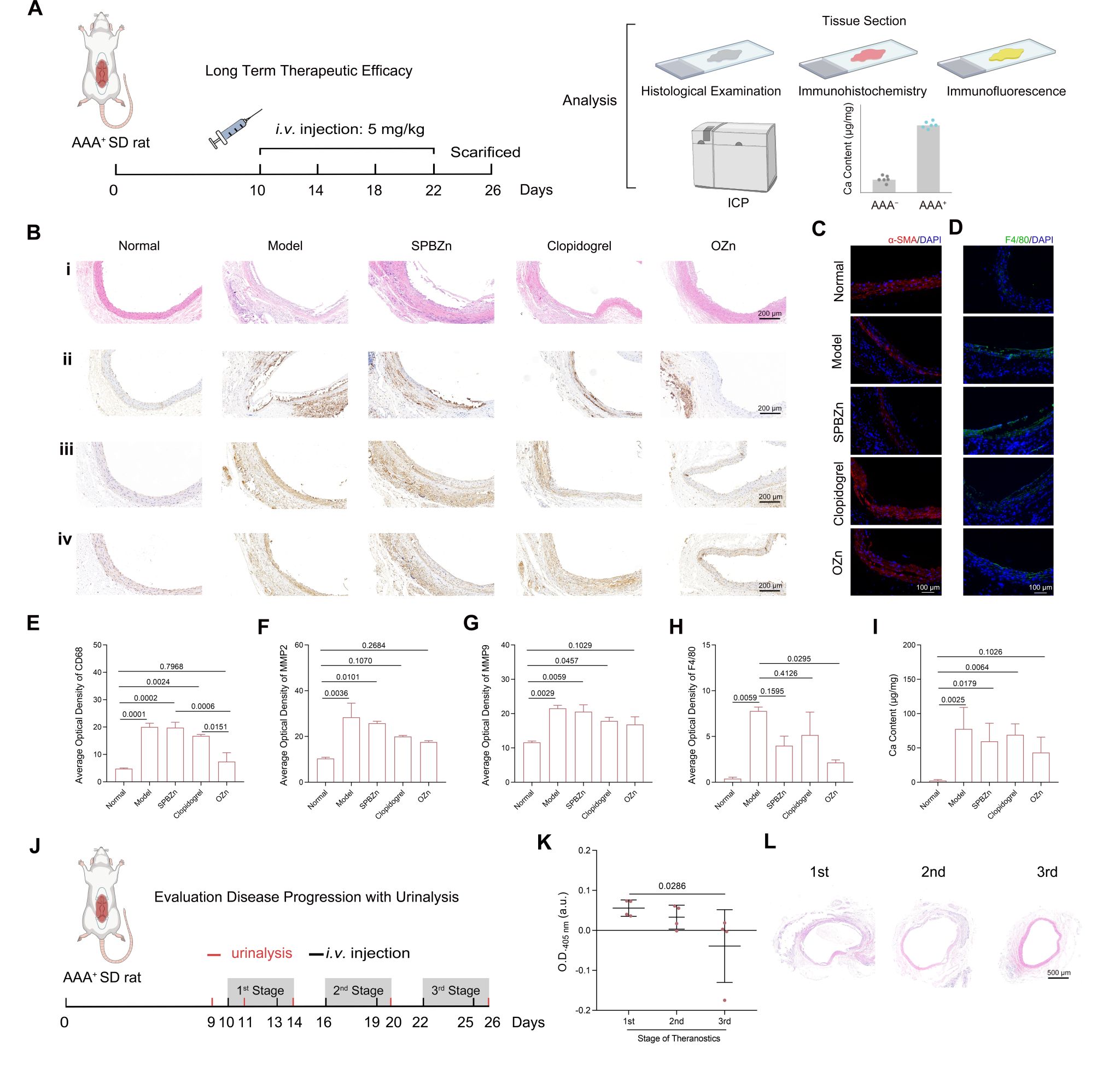 南京大学魏辉教授团队：一种用于腹主动脉瘤管理和治疗效果监测的超小型诊疗纳米酶