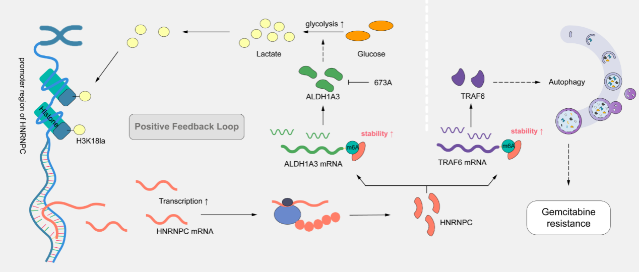 中山大学殷晓煜团队研究胰腺癌化疗耐药新进展
