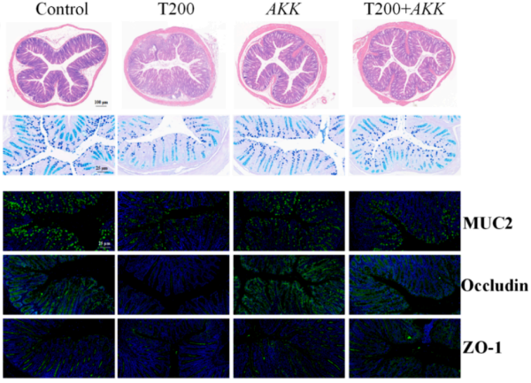研究揭示TBPH经肠道菌群—花生四烯酸代谢轴促炎症性肠病发生机制