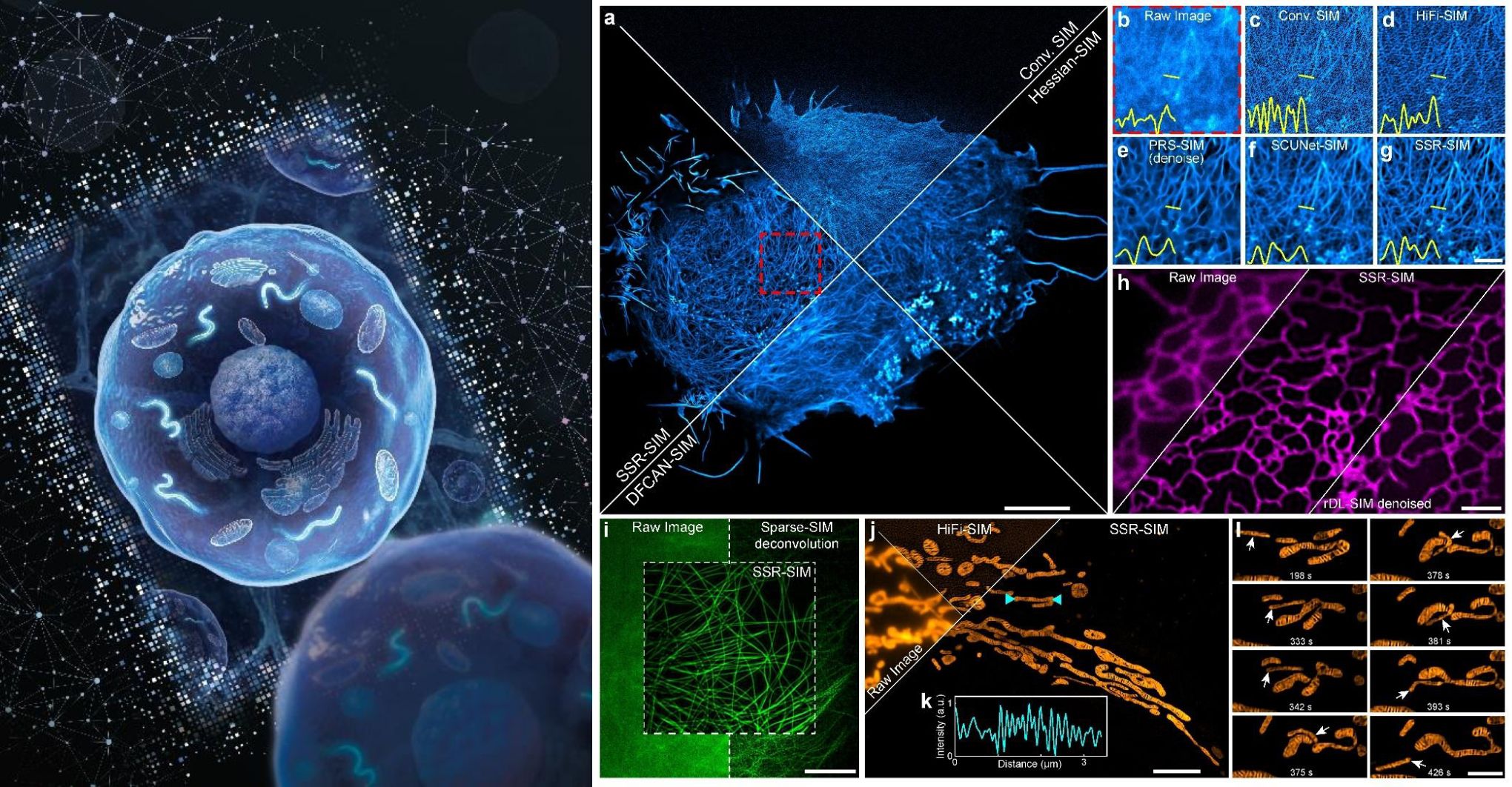华中科技大学人工智能与自动化学院谭山教授合作取得 人工智能技术应用于活细胞超分辨显微成像领域重要成果
